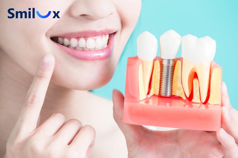 Nữ từ 18 tuổi và nam từ 20 tuổi có thể trồng răng Implant khi xương hàm đã phát triển ổn định