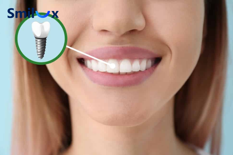 Bia rượu làm chậm quá trình lành thương sau cấy ghép