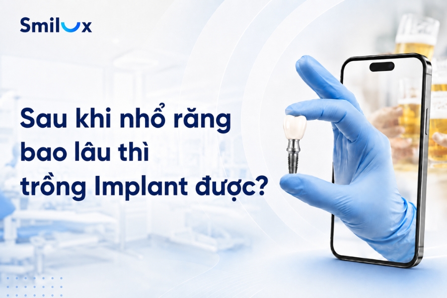 Trồng răng Implant có uống bia được không? Kiêng bao lâu?
