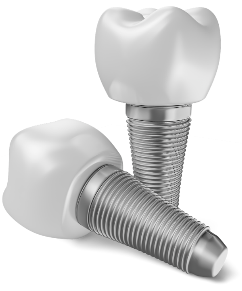 công nghệ implant oti
