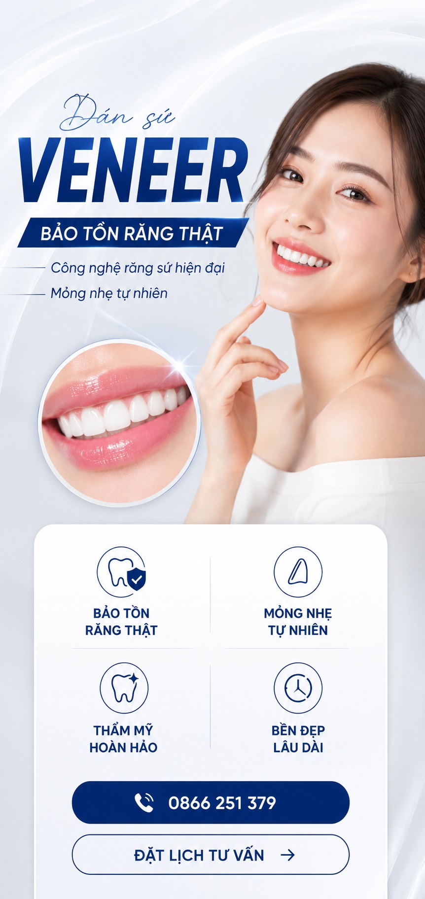 dán răng sứ veneer mobile