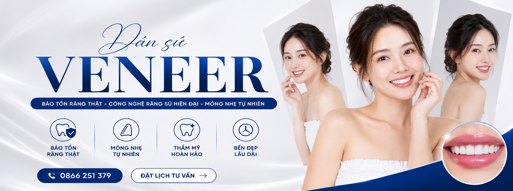 dán sứ veneer tại smilux dental