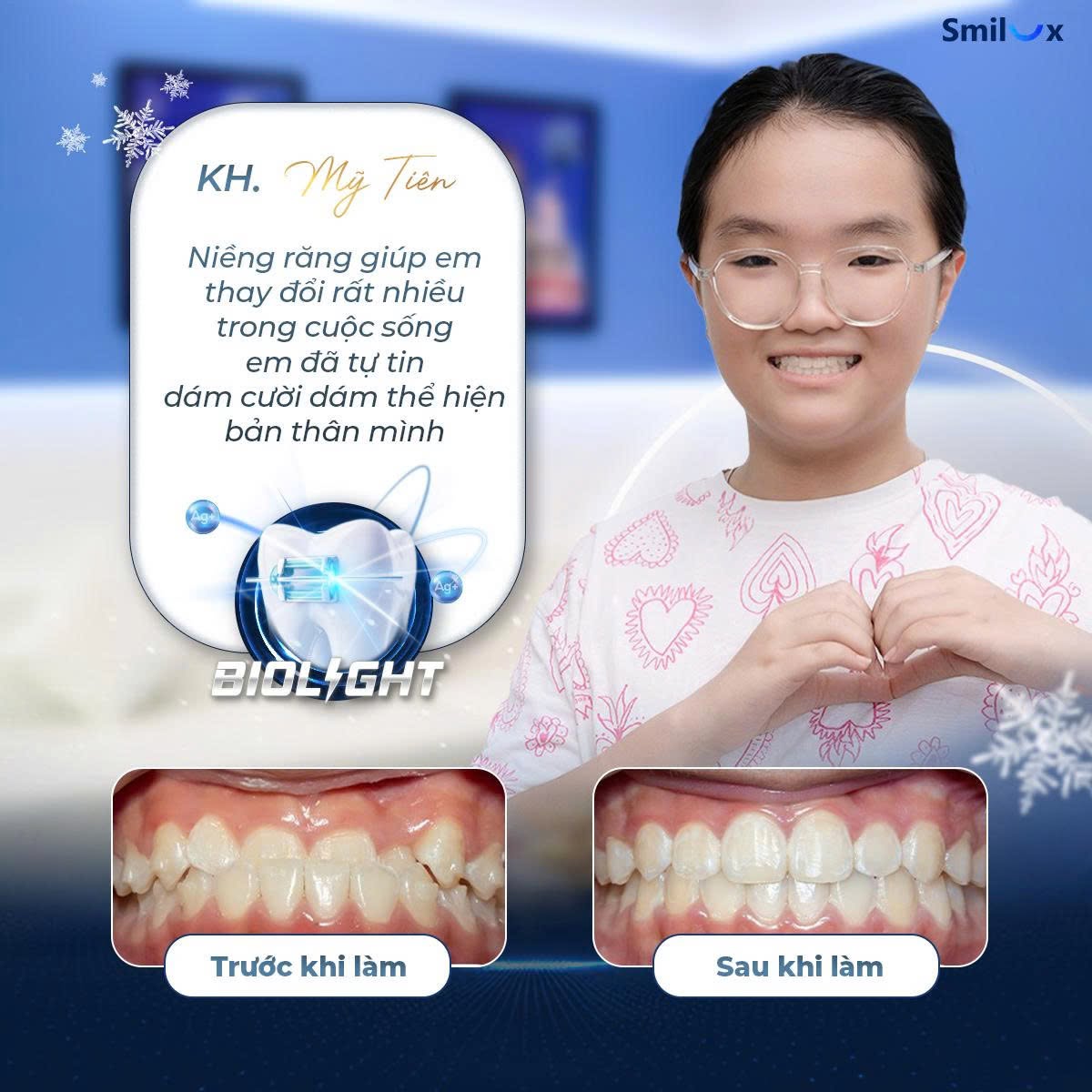 hình ảnh khách hàng niềng răng