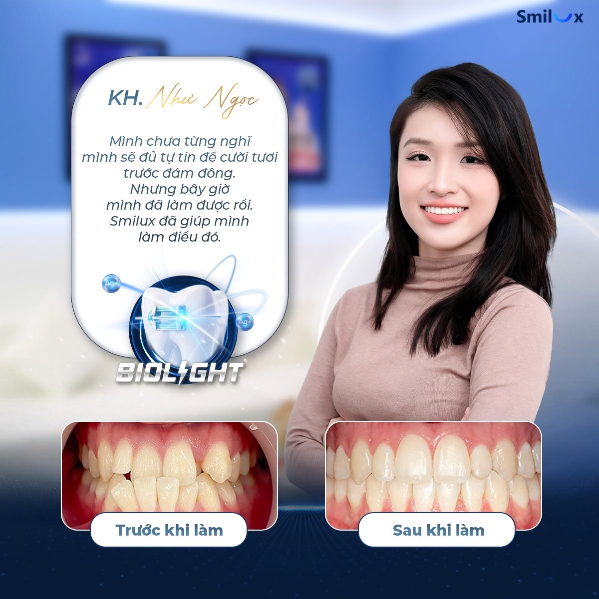 hình ảnh khách hàng niềng răng