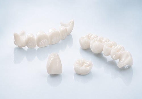 mão răng sứ toàn sứ