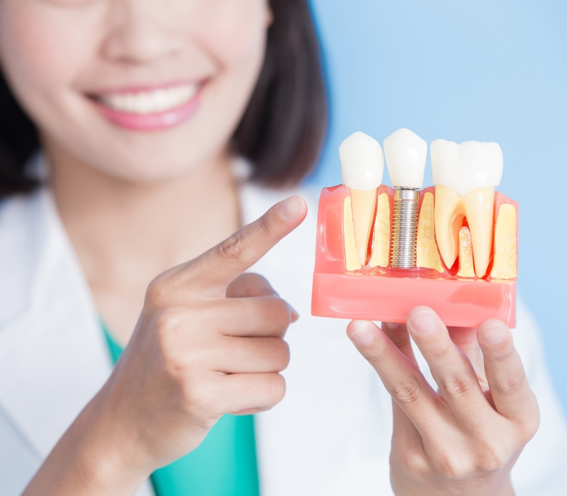 những ai phù hợp trồng răng Implant