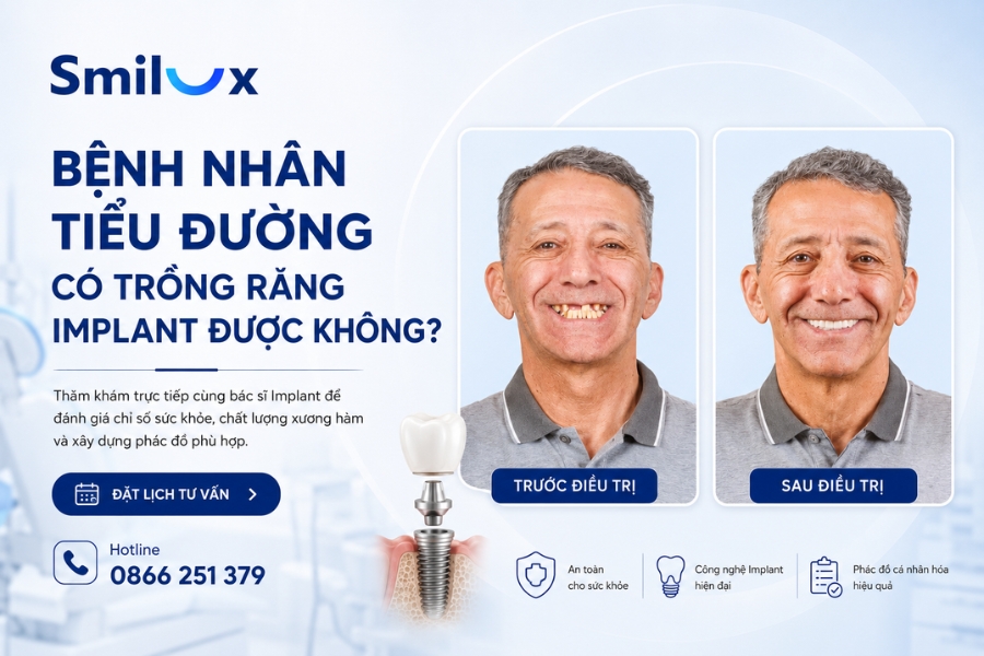 Bệnh nhân tiểu đường có trồng răng Implant được không?