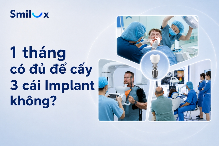 1 tháng có đủ để cấy 3 cái Implant không? Bác sĩ Smilux giải đáp