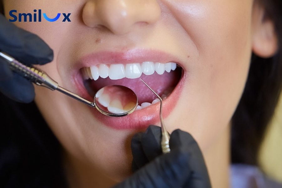 Các tiêu chí lựa chọn địa chỉ trồng răng Implant tại TPHCM