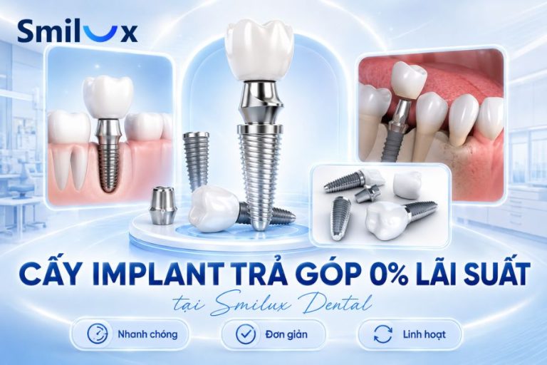Cấy Implant trả góp 0% lãi suất tại nha khoa Smilux TPHCM