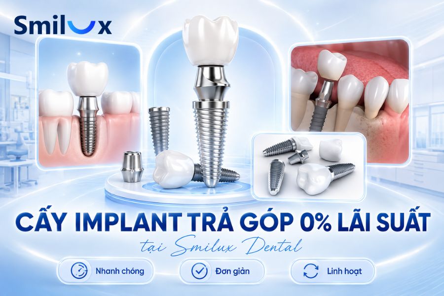 Cấy Implant trả góp 0% lãi suất tại nha khoa Smilux TPHCM