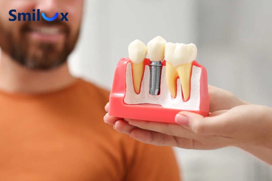 Khi nào có thể thực hiện cấy ghép Implant tức thì?