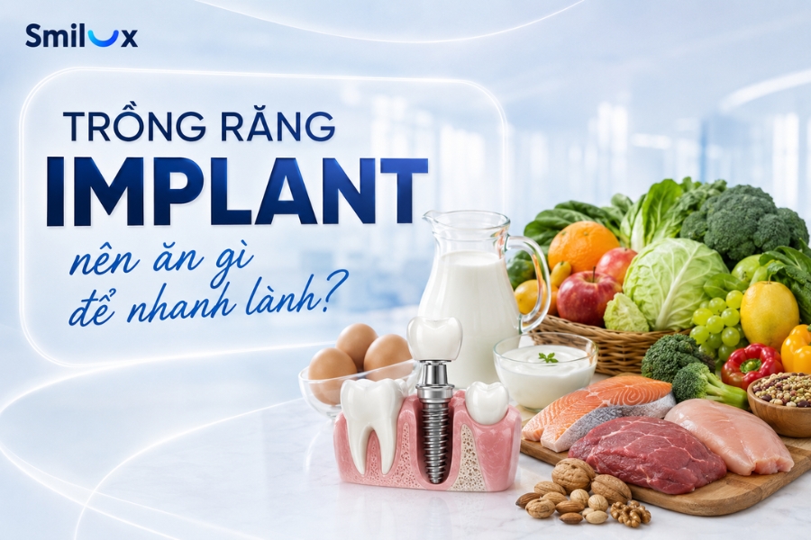 Sau khi trồng răng Implant nên ăn gì để vết thương nhanh lành?