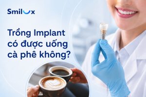 Trồng Implant có được uống cà phê không? Bác sĩ Smilux giải đáp