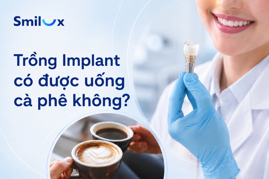 Trồng Implant có được uống cà phê không? Bác sĩ Smilux giải đáp