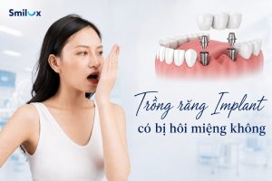 Trồng răng Implant có bị hôi miệng không? Nguyên nhân và cách trị