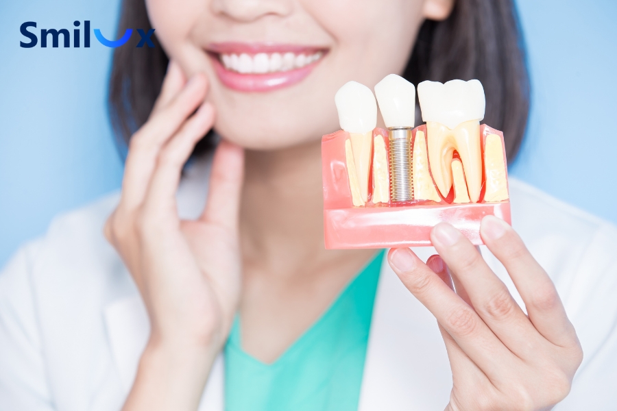 Caffeine làm vết thương quanh Implant lâu hồi phục hơn