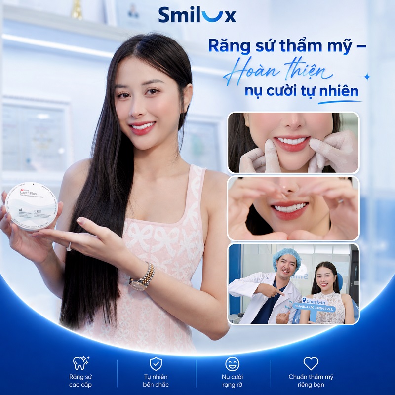 bf af răng sứ