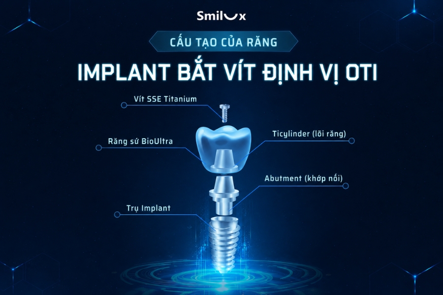 Công nghệ trồng răng bắt vít định vị OTI tại Smilux