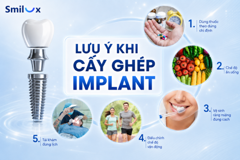 Những lưu ý khi cấy ghép Implant mà bệnh nhân cần biết