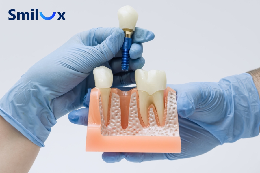 Lời khuyên từ bác sĩ Smilux
