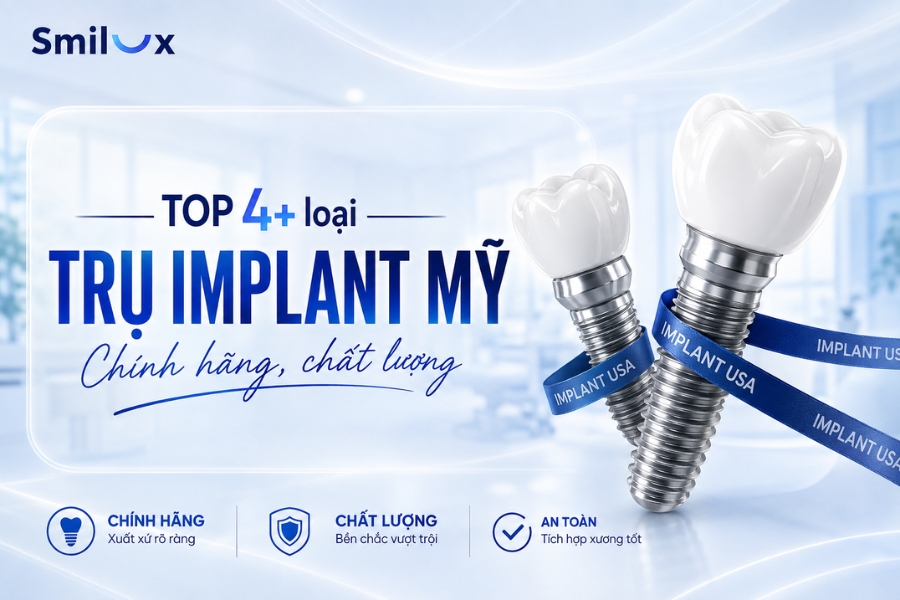 TOP 4+ dòng trụ Implant Mỹ tốt được chuyên gia khuyến nghị
