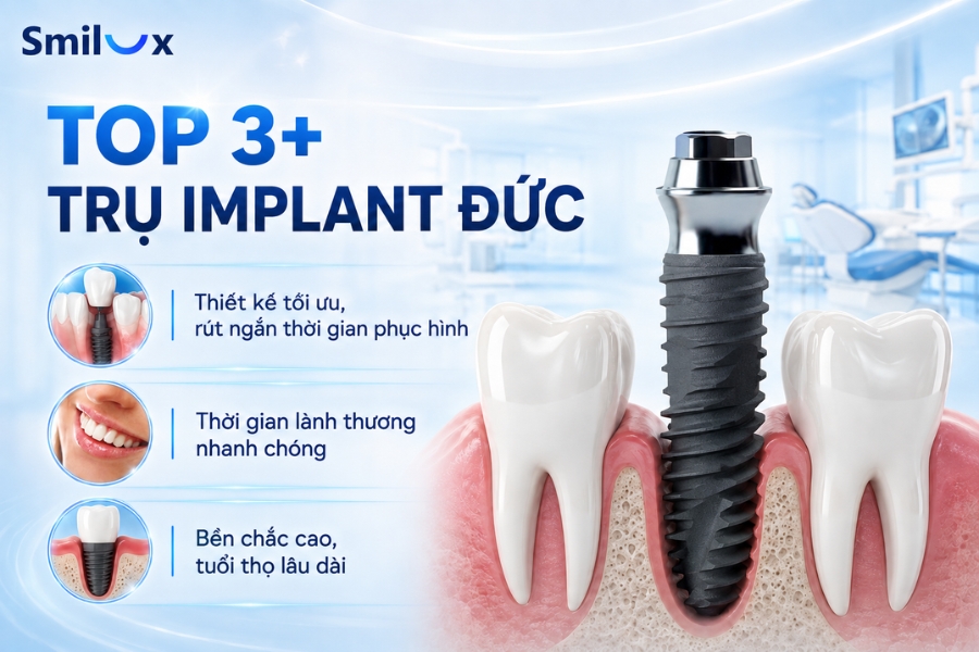 TOP 3+ trụ Implant Đức chất lượng cao, được ứng dụng phổ biến