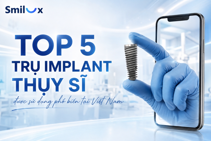 TOP 5 trụ Implant Thụy Sĩ cao cấp được sử dụng phổ biến