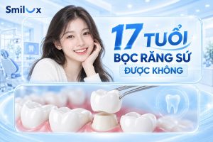 17 tuổi bọc răng sứ được không? Bao nhiêu tuổi được làm răng sứ?