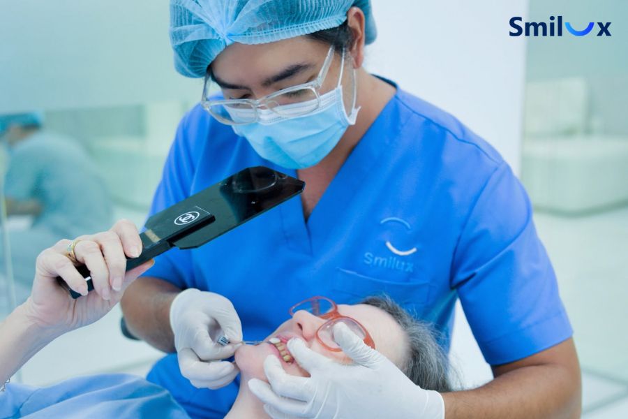 Chọn bác sĩ có kinh nghiệm để hạn chế tình trạng đau răng khi dán