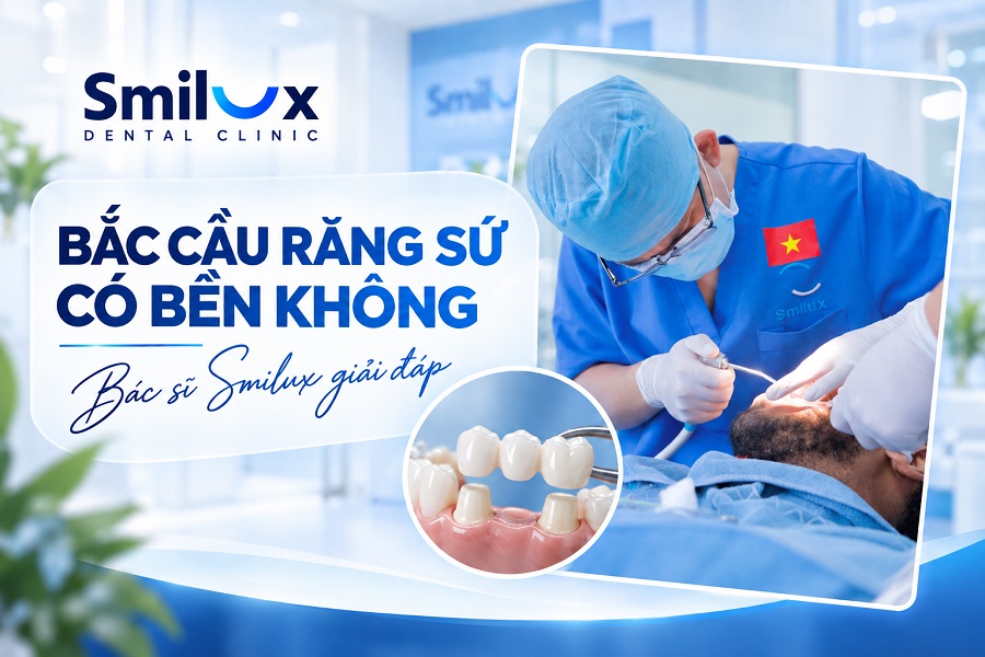 Bắc cầu răng sứ có bền không? Tuổi thọ tồn tại được bao lâu?