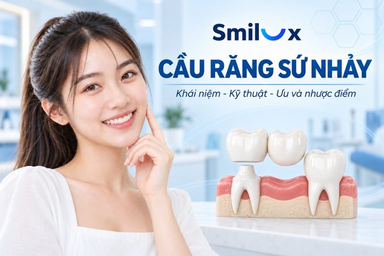 Cầu răng sứ nhảy là gì? Kỹ thuật và ưu nhược điểm trước khi thực hiện