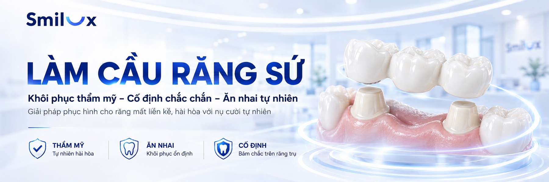cầu răng sứ smilux clinic