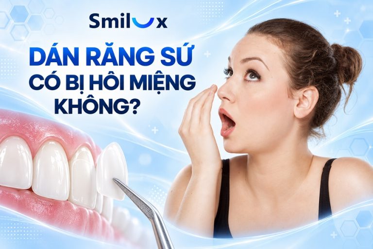 Dán răng sứ có bị hôi miệng không? Bác sĩ Smilux giải đáp