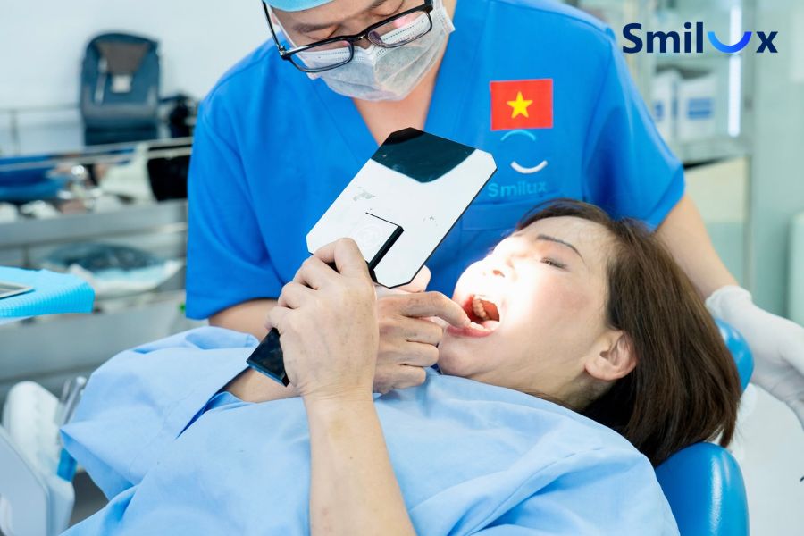 Thời gian thử nghiệm và gắn cố định Veneer kéo dài từ 45 đến 60 phút