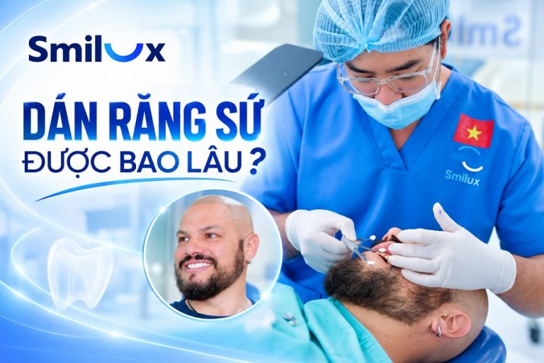Dán răng sứ được bao lâu? Sử dụng có bền không?