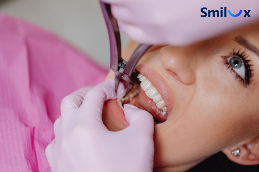 Thời gian làm răng sứ thường mất khoảng 3 đến 7 ngày