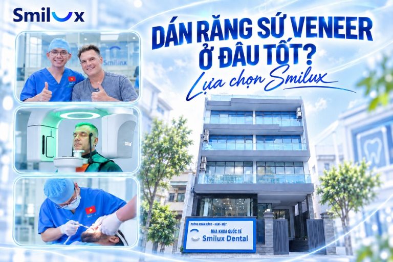 Dán răng sứ Veneer ở đâu tốt? Review các nha khoa uy tín