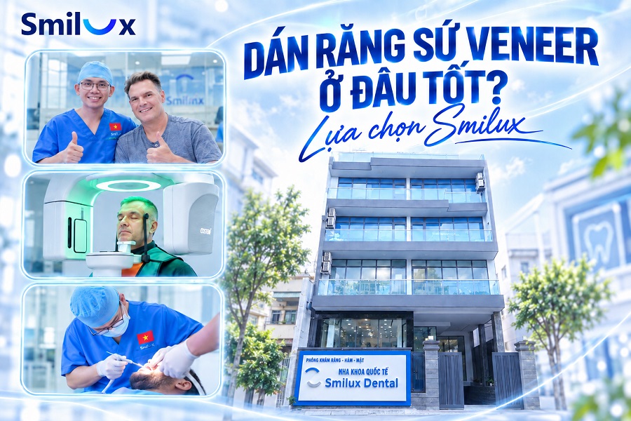 Dán răng sứ Veneer ở đâu tốt? Review các nha khoa uy tín