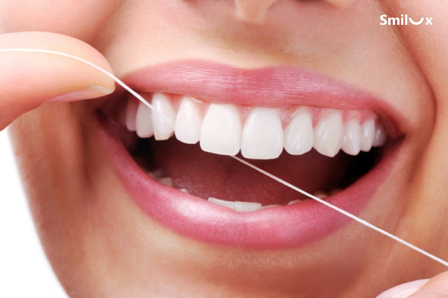 Dùng chỉ nha khoa chuyên dụng để vệ sinh vùng dưới nhịp cầu
