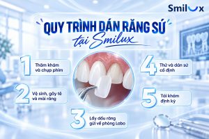 Quy trình dán răng sứ Veneer chuẩn Y Khoa tại Smilux
