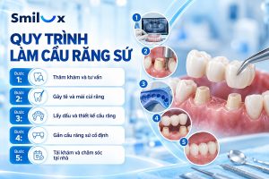 Quy trình làm cầu răng sứ an toàn, chuẩn Y Khoa tại Smilux