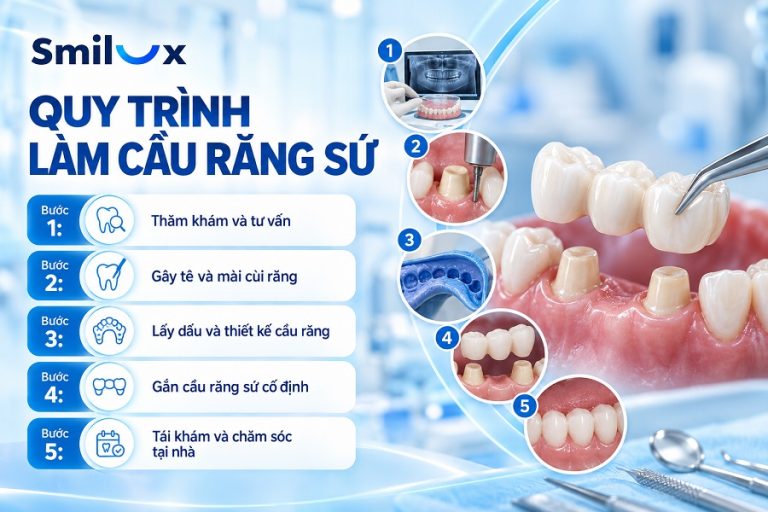 Quy trình làm cầu răng sứ an toàn, chuẩn Y Khoa tại Smilux