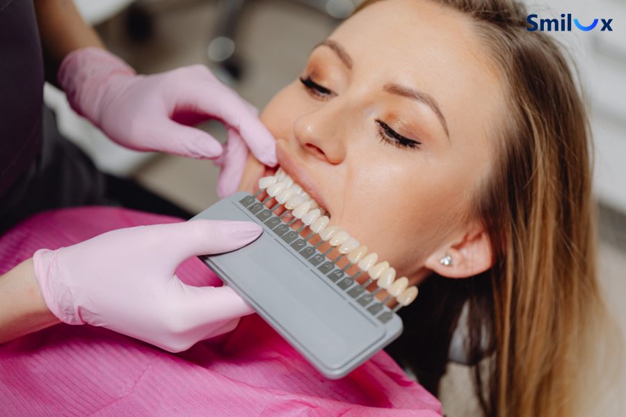 Bạn có thể lựa chọn dán sứ để cải thiện hình dáng những răng cửa không đồng đều