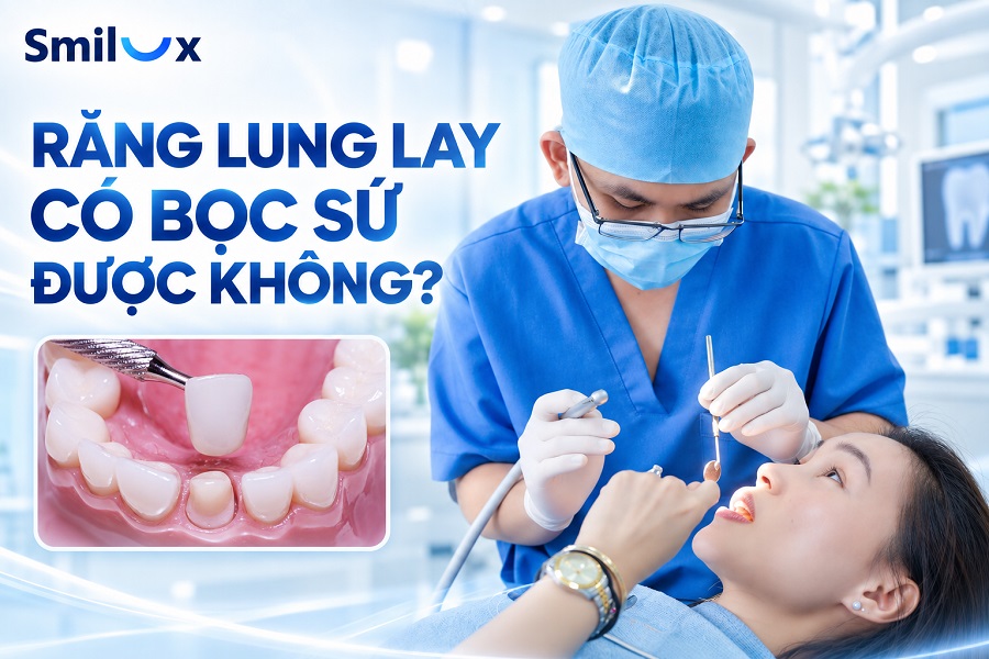 Răng lung lay có bọc sứ được không? Bác sĩ Smilux giải đáp