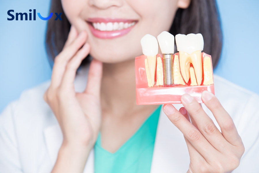 Sau khi lắp mão sứ, duy trì đánh răng 2 lần mỗi ngày và làm sạch kỹ vùng tiếp giáp giữa mão Implant với nướu