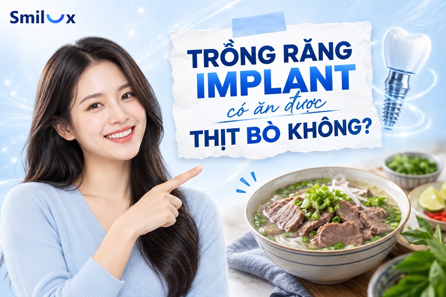 Trồng răng Implant có ăn được thịt bò không? Bác sĩ Smilux giải đáp