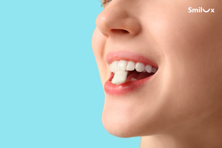 Không cắn đồ cứng như đá viên kẹo cứng để bảo vệ cầu răng sứ
