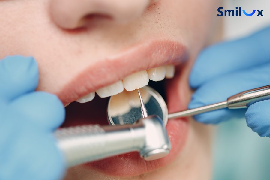 Bác sĩ mài răng bọc sứ chưa chuẩn khiến răng bị cộm