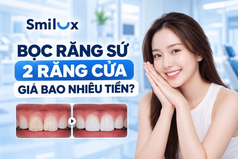Bọc răng sứ 2 răng cửa bao nhiêu tiền? Chi phí mới cập nhật